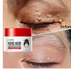 Kojic Acid Skin Whitening Lightening Ultra Brightening Dark Spot Cream Usa