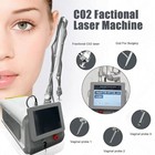 Co2 Fractional Laser Stretch Scar Removal Skin Resurfacing Machine 4d Fotona