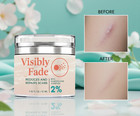 Scar Removal Cream - Rapid Repair Of New   Old Scars  Acne Spots  Burns  Surgery