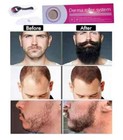 Beard Derma Roller Titanium 540 Beard Growth Roller Micro Needle Acne Scars