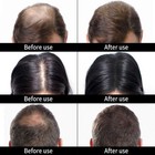 Hair Loss Concealer Medium Brown Ustar Hair Fibers 27 5g Free Shipping