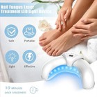 Nail Fungus Laser Nail Fungus Cleaning Led Light Device For Multiple Toenail