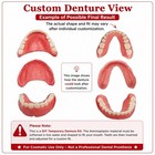 Self-fit Boil   Bite Dent  For Narrow Or Wide Arches - Confidence At Home
