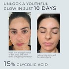 Acne Treatment Bundle Niacinamide Serun 2 Oz   Glycolic Acid Serum 2oz