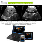 Portable Wireless Ultrasound Probe Scanner Portable Machine Wifi Ultrasound