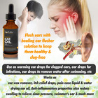 Gotas Para Dolor De O  dos Tapados Inflamados E Infecciones Y Alergia Los O  dos