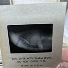 Vintage Medical Clinical 150 Plus Breast Cancer Xrays Bones Tumor Photo Slides