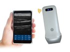 Portable Handheld B w Ultrasound Machine Linear Probewireless Ultrasound Scanner