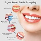 Sejoy Water Flosser Dental Oral Irrigator Portable Rechargeable Teeth Cleaner