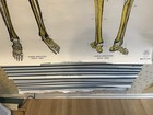 Nystrom Frohse American Anatomical Pull Down Wall Chart Set Of 11 Vintage