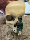Antique Medical Anatomy Study Skull Dissected Model And Temporal Bone