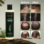 Tgideas Organic Rosemary Hair Growth Shampoo For Women And Men-natural Thickenin