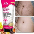 Intimify Stretch Marks Removal Cream  Reduce Scar Before   After Pregnancy 50g