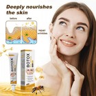 1 5x Bee Venom Botox Wrinkle Cream  Bee Venom Anti-wrinkle Cream wrinkle Removal