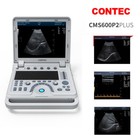 Vet Pet Color Ultrasound Portable Digital Ultrasound Scanner 7 5mhz Linear