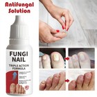 Fungi-nail Anti-fungal Liquid Solution Kills Fungus That Can Lead To Nail