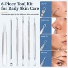 6-in-1 Acne Solution Kit  Blackhead Remover   Pimple Popper Tools