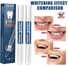 4    Teeth Whitening Gel Pen Extra Strong White Hygiene Tooth Stain Removal Usa