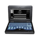 Cms600p2 Portable Ultrasound Scanner Laptop Machine 3 5mhz Convex Probe