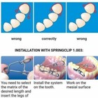 Dental Tor Vm No 1 310 Saddle Metal Matrices Kit  With Springclip Matrix Clip