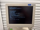 Hitachi Hi-vision 5500 Full Digital Ultrasound System
