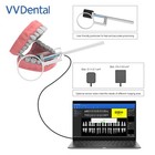 Dental Digital Sensor Rvg High-frequency Intraoral Imaging System Usb Cable