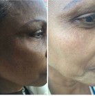 White Fade Super Skin Lightening Cream For Brown Or Dark Skin  2oz  Per Unit 