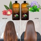 Castor Oil Shampoo Conditioner Set 16oz Thickening Regrowth Antidandruff Unisex