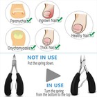 Extra Large Toe Nail Clippers For Thick Hard Nails Cutter Heavy Duty Stainless