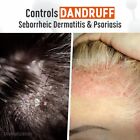 Medicasp Coal Tar Gel Dandruff Shampoo To Treat Seborrheic Dermatitis Psoriasis 