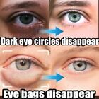 Remove Dark Circles Wrinkles Face Lines Puffy Eyes Under Eye Cream