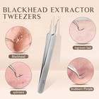 Blackhead Sharp Tweezers Pimple Popper Remover Professional Skin Care Tool
