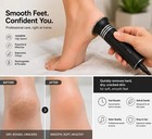 Ipl Laser Hair Removal With Cooling System  At-home Permanent For Women And Men