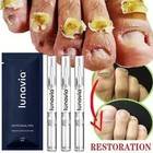 15 6 3pcs Lunavia Antifungal Pen 25  Undecylenic Acid     Toenail Fungus Treatment