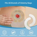 10 Pcs Elastic Colostomy Barrier Strips   10pcs box  Strips 10pcs box
