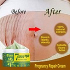     Pregnancy Scar Repair Cream Stretch Marks Removal Fat Stretch Mark Treatment