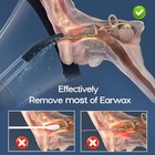 Ear Wax Removal Kit  Effective Safe Electric Cleaner For Earwax Black