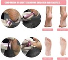 Electric Foot File Callus Remover Professional 60 Count  pack Of 1   Black 