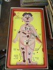 Vintage Milton Bradley Operation Skill Game